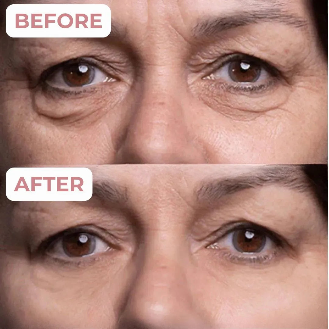Official Anti-Wrinkle Cream