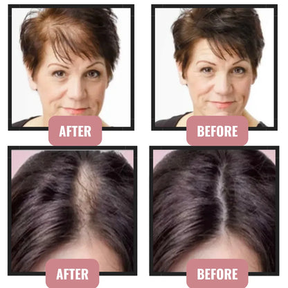 Keratin Hair Fiber – Restore Volume and Conceal Thinning Areas in Seconds