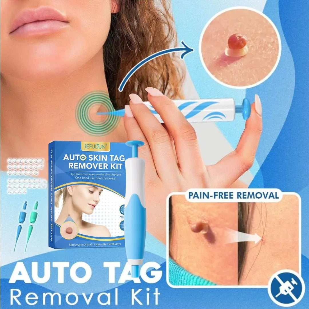 Wart Removal Pen (Skin Tags)
