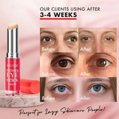 Eye Area Retinol Serum - Lipstick Format