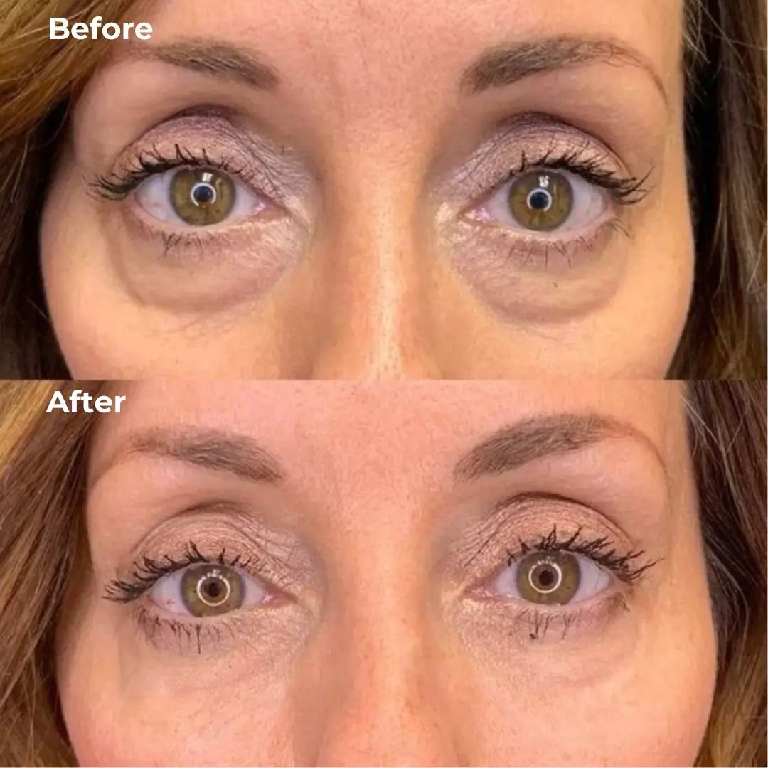 Eye Area Retinol Serum - Lipstick Format
