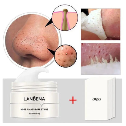 Natural Blackhead Removal Cream