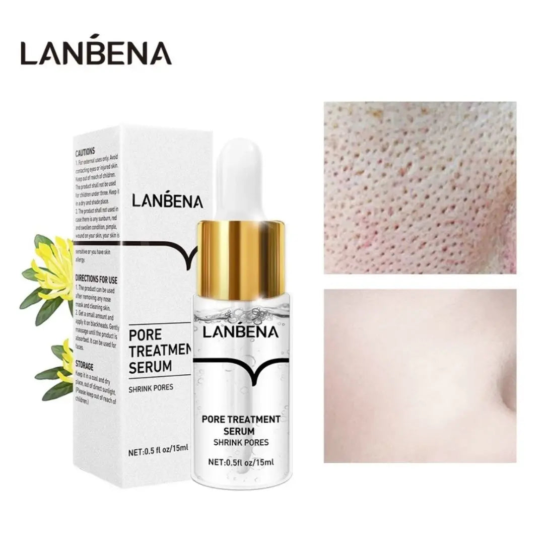 Natural Blackhead Removal Cream