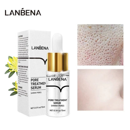 Natural Blackhead Removal Cream