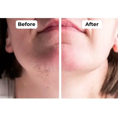 Facial and Body Hair Removal Pen + USB Cable + Cleaning Brush®