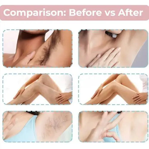 Instant Hair Removal Spray