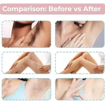 Instant Hair Removal Spray